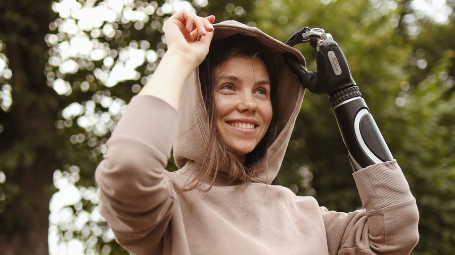 Frau mit einer Prothese am Arm - Berufsunfähigkeitsversicherung